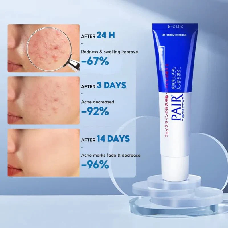 lion pair acne medicated care cream 24 g